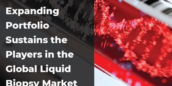 Players-in-the-Global-Liquid-Biopsy-Market