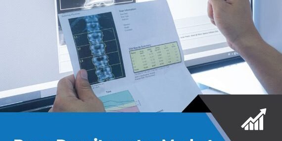 Bone Densitometer Technology Impact on Global Market