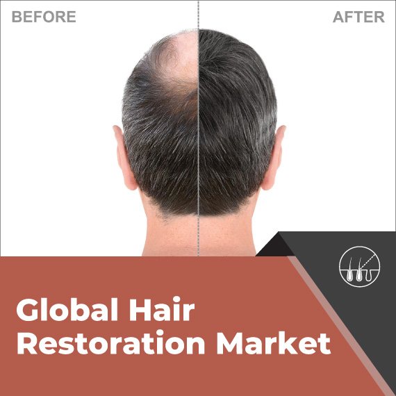 Hair Restoration Market