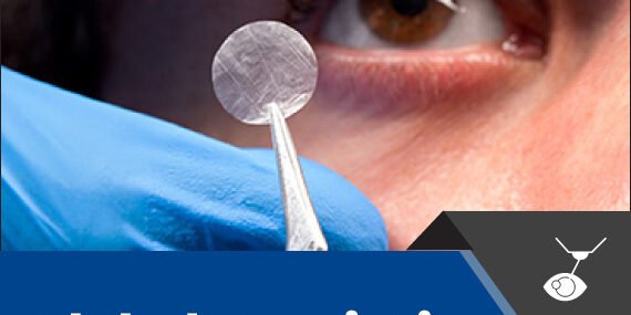 Amniotic Membrane Market – Inkwood Research