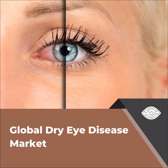 Dry Eye Disease Market: Latest Drug Innovations & Developments
