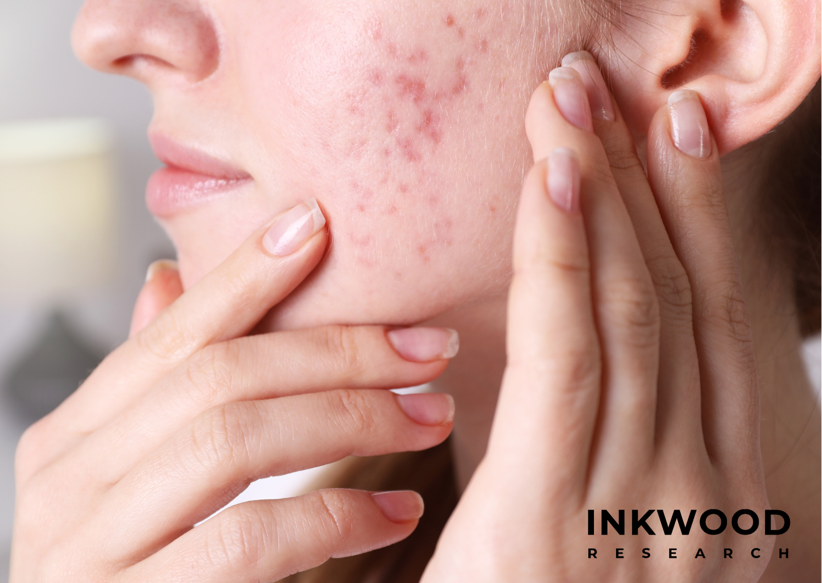 Skincare Industry Trends: K-beauty, anti-aging, AI-powered dermatology devices, and sustainable beauty practices shaping the sector's future.