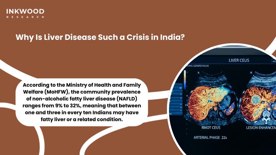 India NAFLD fatty liver disease prevalence data showing liver disease burden across urban and rural Indian populations