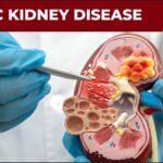 CHRONIC KIDNEY DISEASE (CKD) PIPELINE INSIGHT 2024