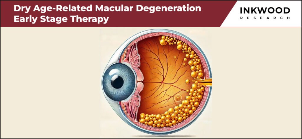 dry-age-related-macular-degeneration-early-stage-therapy