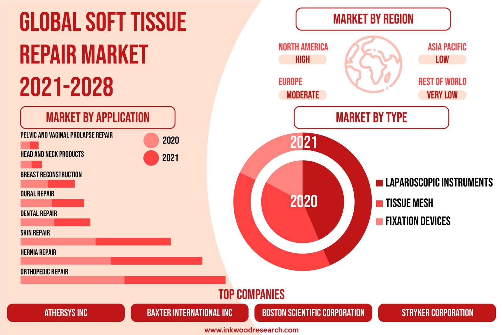 GLOBAL SOFT TISSUE REPAIR MARKET 2021-2028